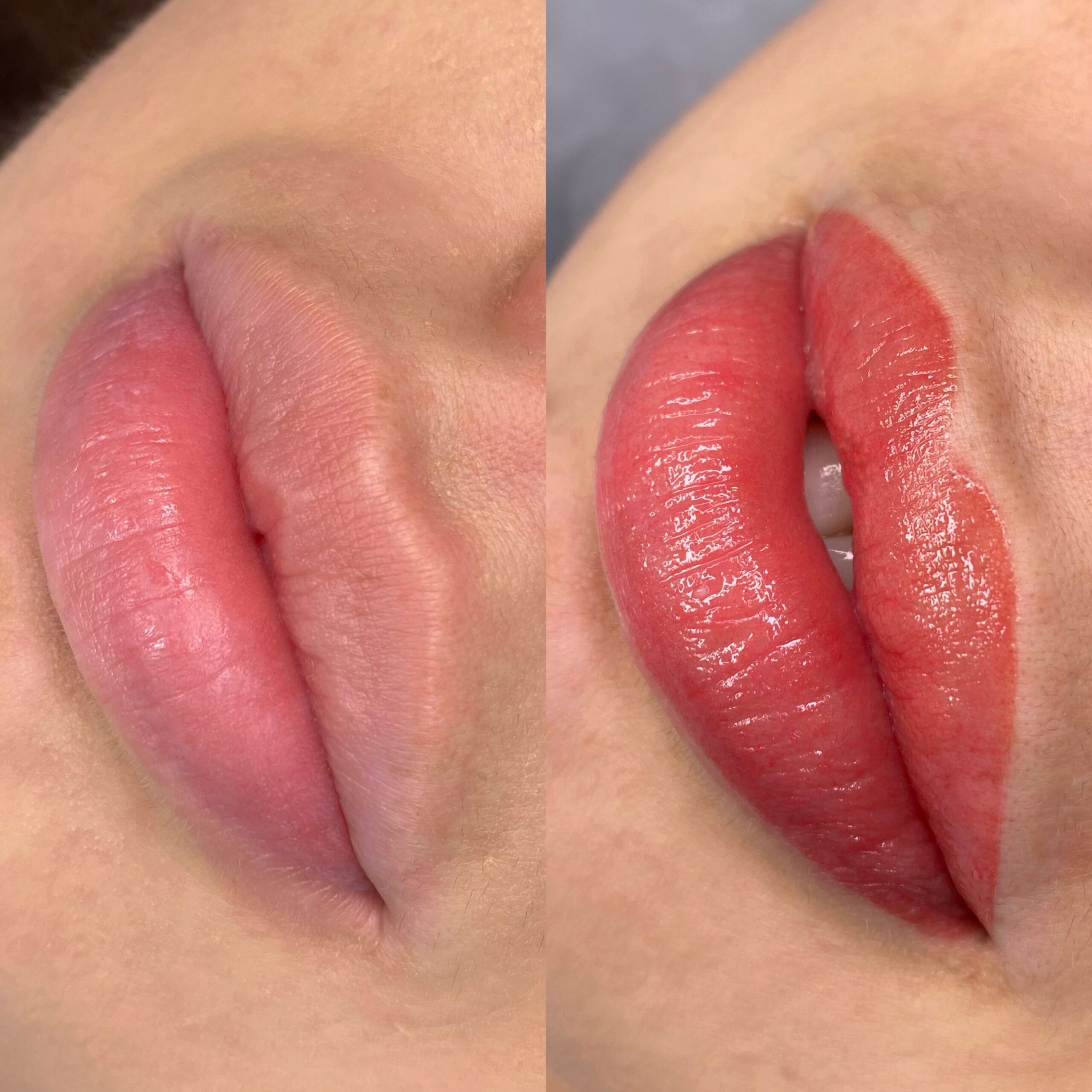 Dudak Renklendirme (Kalıcı Lip Blush) Nedir? Kimlere Uygundur?