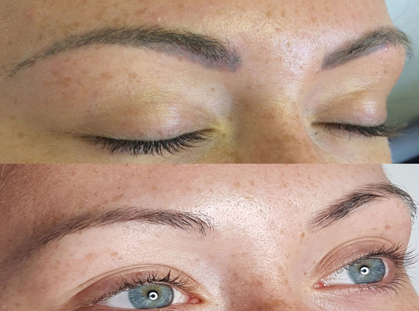 Hatalı Kaş Microblading Nasıl Silinir? Kaş Silme İşlemi Rehberi